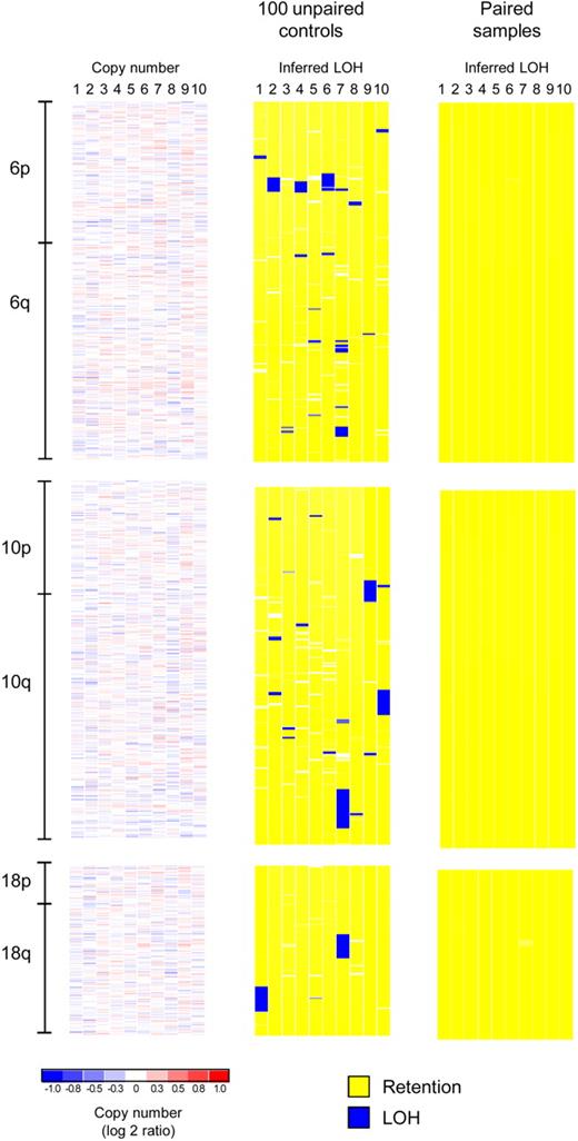Figure 2. False discovery of CNLOH in unpaired studies. An SNP array analysis of 10 MDS patients for chromosomes 6, 10, and 18 is shown (Affymetrix StyI 250K arrays). Copy number analysis (only tumor samples are shown) reveals no deletions or amplifications (left panel), whereas inferred LOH analysis based on paired samples (Figure 1) reveals no LOH (right panel). However, an inferred LOH analysis of 10 patients based on 100 unrelated controls, processed in the same laboratory and core facility, reveals 9 large segments (and several short segments) of falsely discovered LOH resulting from the lack of matched normal samples. The segment sizes are: 4.3, 2.3, 5.6, and 3.5 Mb (chromosome 6, patients 2, 4, 6, and 7), 11.3, 10.6, and 12.6 Mb (chromosome 10, patients 7, 9, and 10), and 12.2 and 10.6 Mb (chromosome 18, patients 1 and 7). The organization of the figure corresponds to Supplemental Figure 3 in Radtke et al.18