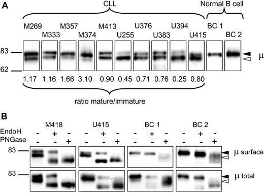 Figure 1. Analysis of μ chains expressed by surface IgM of CLL and normal B cells. (A) Surface proteins were purified from normal B cells and chronic lymphocytic leukemia (CLL) samples, and μ chains were analyzed by immunoblotting. Results are shown from 2 healthy donors (BC1 and BC2) and 10 CLL samples (5 M-CLL, 5 U-CLL), representative of a total of 34 CLL samples. The ratio of expression of the 2 glycoforms of μ chain (mature-immature) is shown for each CLL sample. The immature form (◁) and the mature form (◀) of μ chain are indicated in panels A and B. (B) Purified surface proteins or total cell lysates were treated with EndoH or PNGase or left untreated and analyzed by immunoblotting. Results from 2 healthy donors (BC1 and BC2) representative of a total of 5 independent experiments, and 2 CLL samples representative of a total of 6 independent experiments are shown.
