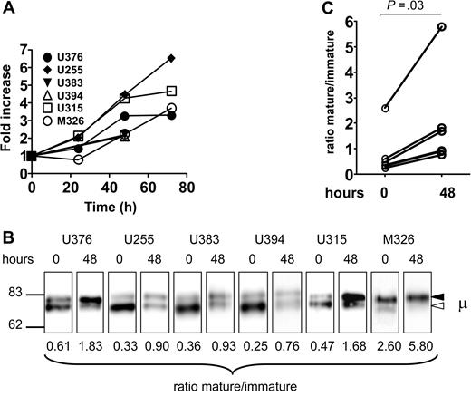 Figure 4. Analysis of sIgM and μ chain glycoform expression after incubation of CLL samples in vitro. (A) CLL samples were incubated in vitro and the expression of sIgM was analyzed by flow cytometry. The graph shows the fold increase of sIgM (MFI), set at 1.0 at time 0, in the 6 samples. (B) Surface proteins were purified from the CLL samples at time 0 and after 48 hours of incubation in vitro, and μ chains were analyzed by immunoblotting. The immature form (◁) and the mature form (◀) of μ chain are indicated. (C) The graph shows the glycoform ratios at time 0 and after 48 hours of incubation. The difference between ratios at 1 and 48 hours are statistically significant (t test, 2-tailed, paired, 99% CI).