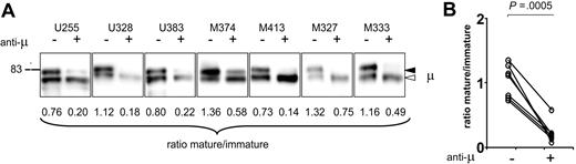Figure 5. Analysis of μ chain glycoform expression in CLL cells after treatment with anti-μ. (A) Surface proteins were purified from 7 CLL samples treated in vitro with anti-μ (+) or isotype control (−) for 24 hours; μ chains were analyzed by immunoblotting. The immature form (◁) and the mature form (◀) of μ chain are indicated. (B) The graph shows the glycoform ratios in anti-μ–treated (+) or isotype control–treated (−) CLL samples measured after 24 hours of incubation in vitro. The difference between ratios between + or − treatments is statistically significant (t test, 2-tailed, paired, 99% CI).