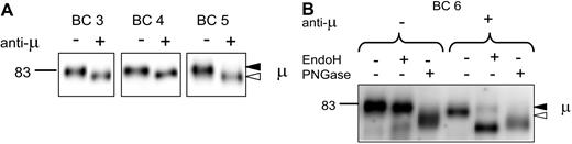 Figure 6. Analysis of μ chain glycoform expression in normal B cells after treatment with anti-μ. (A) Surface proteins were purified from normal B cells of 3 healthy donors treated in vitro with anti-μ (+) or isotype control (−) for 24 hours; μ chains were analyzed by immunoblotting. Data are representative of a total of 5 experiments. (B) Surface proteins from another healthy donor were purified and treated as in panel A for 24 hours. Proteins were then exposed to EndoH or PNGase or left untreated and analyzed by immunoblotting. The immature form (◁) and the mature form (◀) of μ chain are indicated in panels A and B.