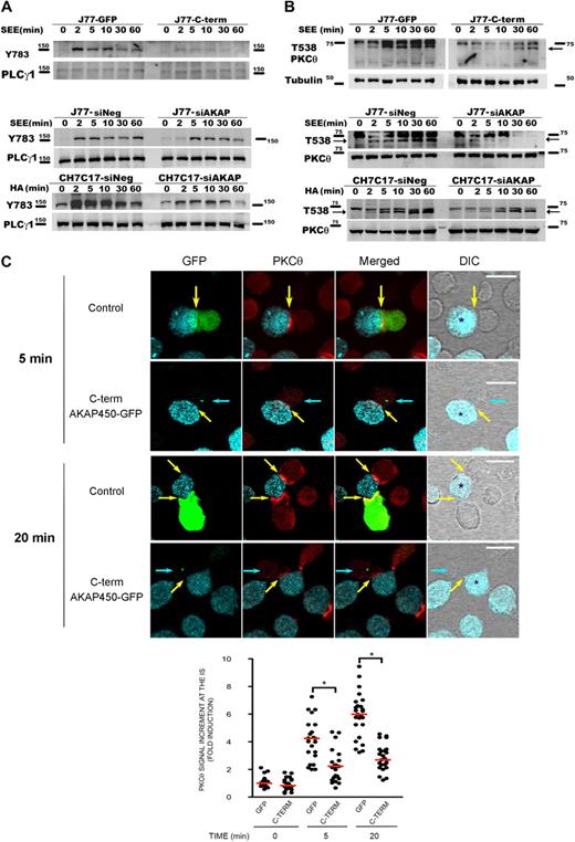Figure 2. Disruption of AKAP450 function impairs the phosphorylation of different molecules associated with the activation of LFA-1. (A) Top blot: J77 expressing GFP (J77-GFP) or C-term AKAP450-GFP (J77-C-term) were conjugated with SEE-pulsed Raji cell for the times indicated, and a representative Western blot of phospho-PLC-γ1 (Y783) is shown. Total PLC-γ1 expression was detected as a loading control. Bottom blots: J77/SEE-pulsed Raji cell conjugates and CH7C17/HOM-2 conjugates expressing control siRNA (siNeg) or AKAP450 siRNA (siAKAP). Control and AKAP450 knockdown T cells were conjugated as in panel A, and representative Western blots of phospho-PLC-γ1 (Y783) are shown. Total PLC-γ1 expression was detected as a loading control. One of 4 representative experiments is shown. (B) Top blot: J77 expressing GFP (J77-GFP) or C-term AKAP450-GFP (J77-C-term) were conjugated as in panel A, and a representative Western blot of phospho-PKC-θ (T538) is shown. Total PKC-θ expression was detected as a loading control. Bottom blots: J77/SEE-pulsed Raji cell conjugates and CH7C17/HOM-2 conjugates expressing control siRNA (siNeg) or AKAP450 siRNA (siAKAP). Control and AKAP450 knockdown T cells were conjugated as in panel A, and representative Western blots of phospho-PKC-θ (T538) are shown. Total PKC-θ expression was detected as a loading control. One of 4 representative experiments is shown. (C) Conjugates were formed between J77 cells expressing GFP or C-term AKAP450-GFP and SEE-pulsed Raji B cells for the different times (5 minutes, top panel; 20 minutes, bottom panel), and were stained for PKC-θ (red). Yellow arrows indicate the positions of immune synapses; blue arrow, position of the mislocalized MTOC in cells overexpressing C-term AKAP450-GFP. Asterisks in DIC images identify CMAC-loaded Raji APCs. Scale bars represent 10 μm. The graph shows the quantification of the total PKC-θ accumulation for the times indicated at the IS. A total of 25 conjugates were counted for each time and condition. Data are the arithmetic mean ± SD of PKC-θ accumulation. *P < .05 compared with J77 cells transfected with GFP (Student t test).