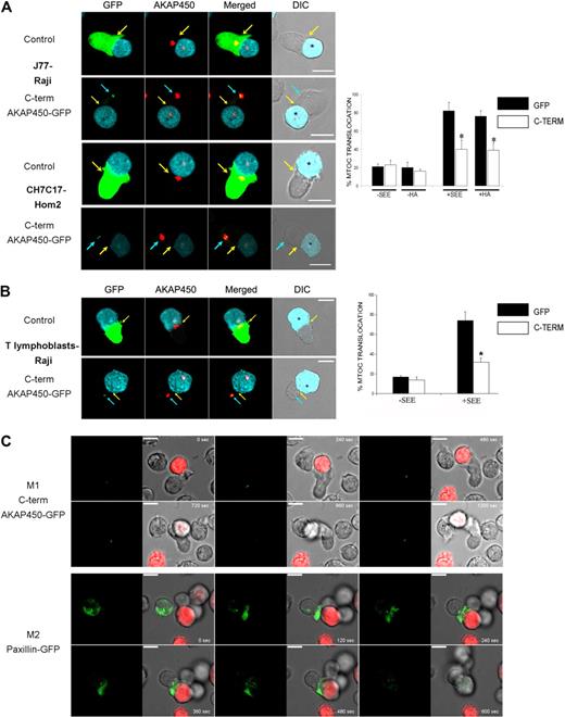 Figure 5. MTOC polarization is prevented by C-term AKAP450-GFP expression. (A) Top panel: Cell conjugates were formed between J77 cells expressing GFP (control) or C-term AKAP450-GFP and SEE-stimulated Raji B cells. Cells were stained for endogenous AKAP450 (red). Bottom panel: Cell conjugates were formed between CH7C17 cells expressing GFP (control) or C-term AKAP450-GFP and HA-stimulated HOM-2 APC. Cells were also stained for endogenous AKAP450. Yellow arrows indicate the positions of immune synapses; blue arrow, position of the mislocalized MTOC in cells overexpressing C-term AKAP450-GFP. Asterisks in DIC images identify CMAC-loaded Raji APCs. Scale bars represent 10 μm. Quantification of MTOC translocation in conjugates formed is shown in the graph. More than 300 conjugates were counted for each condition. Data are the arithmetic mean ± SD of MTOC translocation. *P < .05 compared with J77 or CH7C17 cells transfected with GFP (Student t test). (B) T lymphoblasts were incubated with SEE-pulsed Raji cells loaded with CMAC cell tracker (cyan), fixed, and stained for endogenous AKAP450 (red) as in panel A. Top panel: GFP-expressing T lymphoblasts. Bottom panel: C-term AKAP450-GFP expressing T lymphoblasts. Yellow arrows indicate the positions of immune synapses; blue arrow, position of the mislocalized MTOC in cells overexpressing C-term AKAP450-GFP. Asterisks in DIC images identify CMAC-loaded Raji APCs. The graph shows the quantification of MTOC translocation in conjugates. More than 50 conjugates were counted for each condition. Data are the arithmetic mean ± SD of MTOC translocation. *P < .05 compared with T lymphoblast cells transfected with GFP (Student t test). (C) J77 cells expressing C-term AKA450-GFP (M1) or paxillin-GFP (M2) were incubated with SEE-pulsed Raji B cells loaded with 5-(and-6)-(((4-chloromethyl)benzoyl)amino)tetramethylrhodamine cell tracker (red) and time-lapse confocal video microscopy sequences are shown at the time indicated. Images were captured at 37°C. Time is shown in seconds. M indicates movie. Scale bars represent 10 μm.