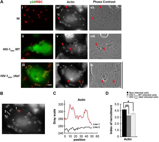 Figure 2. Presence of F-actin at phagocytic sites in HIV-1–infected macrophages. (A) Primary human macrophages were infected with HIV-1ADAWT or HIV-1ADAΔNef or noninfected for 8 days. The cells were incubated for 5 minutes with IgG-RBCs, then fixed and stained with AMCA-anti–rabbit IgG to reveal external RBCs. The cells were then permeabilized and labeled with anti-p24, followed by Cy2-anti–goat IgG and Alexa633-phalloidin to stain F-actin (iv-vi). Merged images show p24 in green and RBCs in red (i-iii). Arrowheads indicate examples of F-actin cups. Cells were analyzed by wide-field fluorescence microscopy and phase contrast (vii-ix). Bar represents 10 μm. (B) Noninfected cells were treated as described in panel A. (C) The profile of F-actin fluorescence intensities along the lines drawn at the phagocytic site (line 1) and in the cell body (line 2) are shown. (D) Noninfected cells and infected cells were treated as described in panel A. The fluorescence intensities measured in the phagocytic cups were background subtracted and divided by the fluorescence intensities measured for cortical actin in the cell body after background substration. This ratio defined the index of recruitment. The means ± SEM of 3 independent experiments are plotted (n = 78 actin cups per condition).
