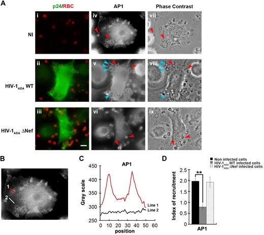Figure 3. Inhibition of AP1 recruitment at phagocytic sites in HIV-1 infected cells. (A) Primary human macrophages were infected with HIV-1ADAWT or HIV-1ADAΔNef or noninfected for 8 days. The cells were incubated for 5 minutes with IgG-RBCs, fixed, and stained with AMCA-anti–rabbit IgG to reveal external RBCs. The cells were then permeabilized and labeled with anti-p24 followed by Cy2-anti–goat IgG and with anti-AP1 (γ-adaptin) followed by Cy3-anti–mouse IgG (iv-vi). Merged images show p24 in green and RBCs in red (i-iii) and phase-contrast images are shown (vii-ix). Red arrowheads indicate AP1 enrichment in some forming phagosomes, whereas cyan arrowheads show no enrichment. Bar represents 10 μm. (B) Noninfected cells were treated as described in panel A. (C) The profile of AP1 (γ-adaptin) fluorescence intensities along the lines drawn at the phagocytic site (line 1) and in the cell body (line 2) are shown. (D) The AP1 fluorescence intensity measured in the phagocytic cups were background subtracted and divided by the AP1 fluorescence intensity measured in the cell body after background substraction. This ratio defines the index of recruitment. The means ± SEM of 3 independent experiments, each with 6 noninfected and 6 infected cells, are plotted.