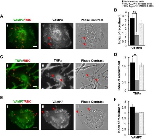 Figure 6. HIV-1 infection perturbs membrane delivery of VAMP3- and TNFα-positive compartments but not VAMP7-positive compartments during phagocytosis. (A) Primary human macrophages were incubated for 5 minutes with IgG-RBCs, fixed, and stained with AMCA-anti–mouse IgG to reveal external RBCs. The cells were then permeabilized and labeled with anti-VAMP3, followed by Cy3-anti–rabbit IgG (ii). Merged images show VAMP3 in green and RBCs in red (i). Arrowheads indicate VAMP3 enrichment in phagocytic cup in formation. Cells were analyzed by wide-field fluorescence microscopy and a phase-contrast image is shown (iii). Bar represents 10 μm. (C) Macrophages were treated as in panel A, except that they were labeled with anti-TNFα, followed by Cy3-anti–mouse IgG (ii). Merged images show TNFα in green and RBCs in red (i). Arrowheads indicate TNFα enrichment in phagocytic cup in formation. Bar represents 10 μm. (E) Macrophages were treated as in panel A, except that they were labeled with anti-VAMP7, followed by Cy3-anti–mouse IgG (ii). Merged images show VAMP7 in green and RBCs in red (i). Arrowheads indicate VAMP7 enrichment in phagocytic cup in formation. Bar represents 10 μm. (B,D,F) The VAMP3 (B), TNFα (D), or VAMP7 (F) fluorescence intensities measured in the phagocytic cups were background subtracted, and divided by the respective fluorescence intensities measured in the cell body after background substraction. The ratio defines the index of recruitment. The means ± SEM of 3 independent experiments with 6 noninfected and 6 infected cells are plotted. HIV-1ADAWT infection significantly inhibited VAMP3 and TNFα, but not VAMP7, recruitment at the phagocytic cup compared with control cells.