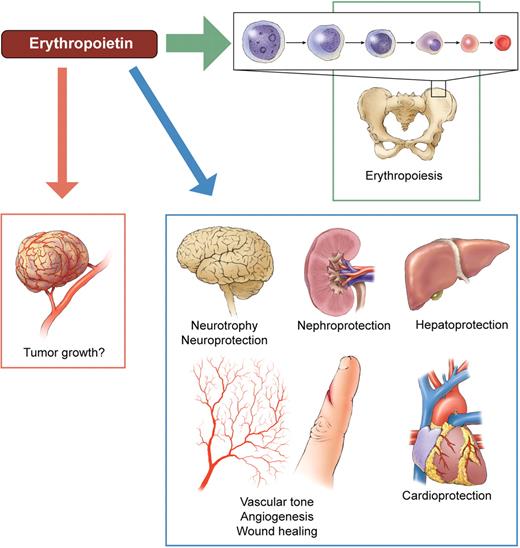 Alleged targets of erythropoietin. The primary task of the hormone (and its therapeutic analogs) is to maintain myeloid erythropoiesis, by preventing erythrocytic progenitors from undergoing apoptosis and by stimulating their proliferation and differentiation. Erythropoietin receptors have been claimed to be present throughout the body, suggesting that erythropoietin is a pleiotropic survival and growth factor. As a result, the alleged erythropoietin's tissue protective potential has already been investigated in clinical trials, for example, in brain and heart diseases. Whether erythropoietin can stimulate cancer growth by promoting tumor cell survival and angiogenesis is an even more controversial issue. Professional illustration by Kenneth X. Probst.