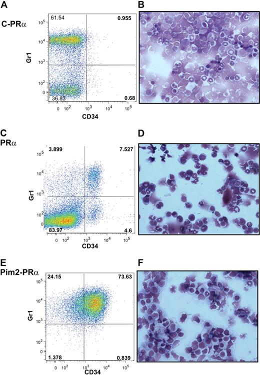 Figure 5. Immunophenotypic and morphologic characterization of Pim2-PRα–induced leukemias. Costaining of CD34 and Gr1 on BM cells and cytospin morphology from mice that received a transplant of empty vector–transduced PRα bone marrow (A-B), diseased knock-in PRα mice (C-D; that did not undergo transplantation), and mice that received a transplant of Pim2-transduced PRα bone marrow after developing leukemia (E-F) is shown. For analysis of CD34 and Gr1, live cells (4,6 diamidino-2-phenylindole negative) were gated for CD45.2+ (donor cells), and subsequent percentages of cells positive for CD34 and or Gr1 were calculated. Cytospin preparations of BM cells were stained with Wright-Giemsa (original magnification ×60).