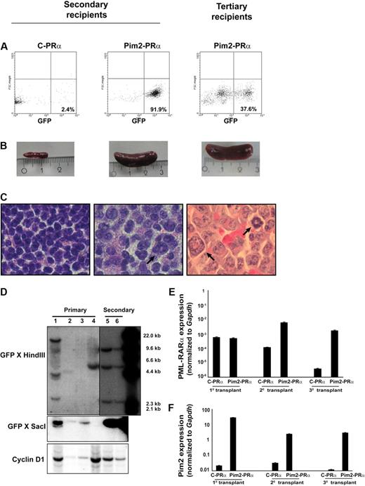 Figure 6. The Pim2–PML-RARα–induced leukemia is transplantable. (A) GFP-positive cells were detected by flow cytometry in the bone marrow and spleen from secondary and tertiary recipients of Pim2–PML-RARα (Pim2-PRα) cells. (B) Photographic image of spleens of the indicated mice. (C) Histologic section of the spleen from secondary and tertiary recipients, stained with hematoxylin and eosin (original magnification ×100). The arrows indicate the infiltration of the spleen of secondary and tertiary recipients by myeloid cells. (D) Southern blot analyses of provirus integration into the bone marrow of primary (lanes 1-4) and secondary (lanes 5-6) transplants. BM cells from lane 1 were used for secondary transplantation. The genomic DNA was digested with HindIII and SacI and probed with GFP sequences. To monitor for loading in the HindIII digest, the blot was reprobed with cyclinD1. (E-F) Real-time RT-PCR was performed on the mRNA samples isolated from spleen of recipient mice. Gapdh was used as an internal control for each experiment. Expression was analyzed in several mice from each group and was repeated independently 2 times. Data shown here are from 1 representative mouse from each group of animals that underwent serial transplantation.