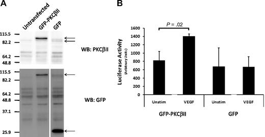 Figure 5. Role of overexpressed PKCβII in VEGF-stimulated induction of PKCβ mRNA expression. (A) Western blot analysis of PKCβII and GFP expression in an endothelial cell line (EAhy926) transfected to overexpress GFP-PKCβII or GFP. (B) Effect of 100 ng/mL VEGF on PKCβ promoter-driven luciferase activity in GFP-PKCβII- and GFP-transfected endothelial cells (n = 4).