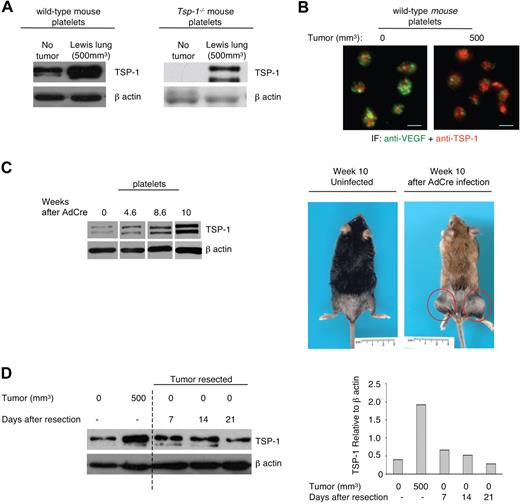 Figure 1. TSP-1 expression in platelets is an indicator of tumor growth and regression. (A) Western blot analysis of TSP-1 expression in equivalent numbers of platelets harvested from wild-type and Tsp-1−/− mice immediately after inoculation (No tumor) with Lewis lung cells that express TSP-1 and in mice with tumor volumes of 500 mm3. β-Actin was probed as a loading control. (B) Immunofluorescence analysis of TSP-1 (red) and VEGF (green) expression in platelets harvested from wild-type mice before tumor growth (0) and after tumors reached 500 mm3 (500). Platelets were immunostained with secondary antibody alone to ensure specificity (data not shown). Bar represents 2 μm. (C) Western blot analysis of TSP-1 expression in platelets isolated from an inducible tumor model, LSL-K-rasG12D x p53fl/fl mice, after Adeno-Cre-induced sarcoma formation in the extremities. β-Actin was probed as a loading control. Right: Images of LSL-K-rasG12D x p53fl/fl mice that were mock infected (uninfected) and 10 weeks after Adeno-Cre infection. Red circles represent sarcomas. (D) Platelet TSP-1 expression by Western blot is probed during tumor growth and after tumor resection on the indicated days. β-Actin was probed as a loading control. Right: Quantification of TSP-1 expression relative to β-actin.