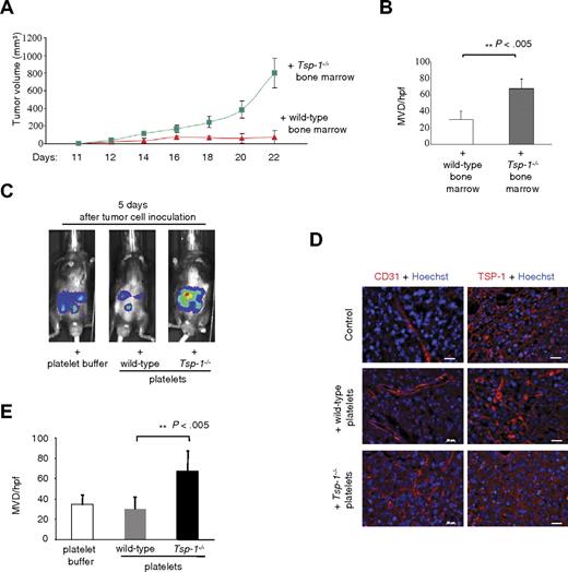 Figure 2. Loss of TSP-1 in platelets leads to accelerated tumor growth and increased tumor angiogenesis. (A) Lewis lung tumor cells were inoculated in the flank, and tumor growth was measured by calipers at the indicated days in lethally irradiated Tsp-1−/− mice transplanted with either Tsp-1−/− bone marrow (green line; n = 5) or wild-type bone marrow (red line; n = 5). (B) Microvessel density (MVD) per high-power field (hpf) was quantified in equivalent volume tumors harvested from Tsp-1−/− mice transplanted with wild-type or Tsp-1−/− bone marrow (P < .005). (C) Bioluminescence images of intraperitoneal tumors in mice after injections of platelet buffer alone, 109 wild-type, or Tsp-1−/− platelets. (D) CD31 and TSP-1 immunofluorescence of tumors harvested from mice injected with platelet buffer alone (control), wild-type platelets, or Tsp-1−/− platelets. Tumors were immunostained with an antibody against CD31 (left panels) to detect endothelial cells and for TSP-1 (right panels). Bar represents 20 μm. (E) MVD/hpf was quantified by CD31 immunostaining of intraperitoneal tumors harvested from mice injected with platelet buffer, wild-type platelets, or Tsp-1−/− platelets (P < .005).