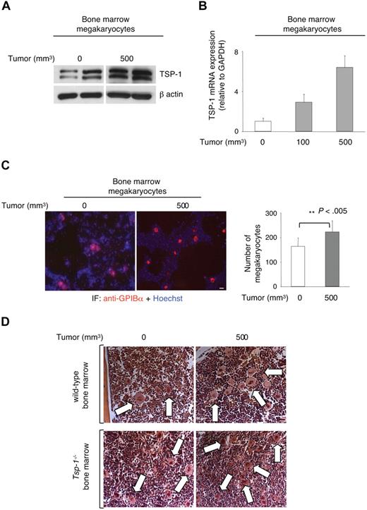Figure 4. Megakaryopoiesis and TSP-1 expression are increased in the bone marrow of tumor-bearing wild-type mice. (A) Western blot for TSP-1 expression in megakaryocytes isolated from the bone marrow of Lewis lung tumor-bearing mice. β-Actin was probed as a loading control. (B) Tsp-1−/− mRNA levels in bone marrow megakaryocytes were quantified by quantitative polymerase chain reaction and compared with the housekeeping gene GAPDH before tumor growth (0), and when tumors reached 100 mm3 and 500 mm3 in volume. (C) Immunofluorescence analysis of bone marrow cytospins with anti-GPIBα (red) and Hoechst (blue) to detect megakaryocytes. Bar represents 50 μm. Right: Quantification of GPIBα+ cells in the bone marrow of non–tumor-bearing (0) or tumor-bearing mice (500 mm3). (D) Femurs from control and tumor-bearing wild-type and Tsp-1−/− mice were stained with hematoxylin and eosin. Arrows indicate megakaryocytes. Bar represents 50 μm.
