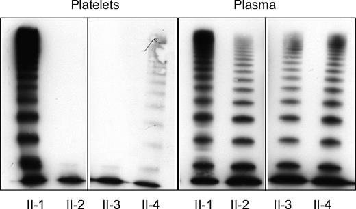 Figure 3. Plasma and platelet VWF multimers in unaffected and affected family members. Plasma and platelet VWF multimers were assessed by SDS-agarose gel electrophoresis and Western blotting. Vertical line(s) have been inserted to indicate a repositioned gel lane. Lane 1 in both frames: platelet and plasma VWF of unaffected heterozygous family member, II-1. Lanes 2-4: affected family members II-2, II-3, and II-4 with a homozygous N528S VWF mutation. Affected family members have an abnormal plasma multimer distribution with a relative decrease of large multimers and pronounced oligomers and either a complete loss (II-2, II-3) or a severely decreased concentration (II-4) of large platelet VWF multimers.