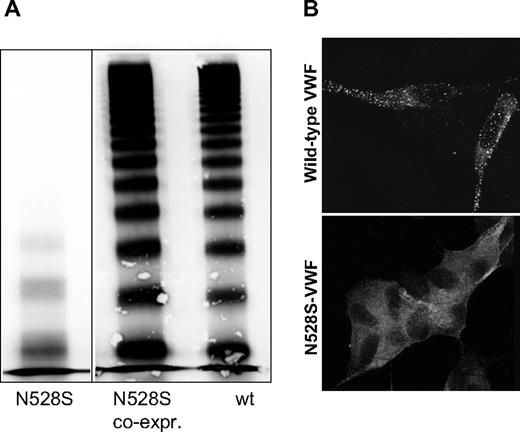 Figure 4. Multimer distribution and intracellular localization of recombinant N528S-VWF. (A) Mutant N528S-VWF (lane 1) alone and coexpressed with wt VWF (lane 2) in 293 EBNA cells in the conditioned medium was assessed by SDS-agarose electrophoresis and Western blotting. Vertical line(s) have been inserted to indicate a repositioned gel lane. Recombinant wt VWF multimers are shown for comparison (lane 3). N528S-VWF multimers lack HMWM completely, whereas N528S coexpressed with wt VWF could not be distinguished from wt VWF alone. (B) AtT-20 cells were transiently transfected with (top panel) wild-type VWF or (bottom panel) N528S-VWF. Cells were immunostained for VWF and examined by confocal microscopy. N528S-VWF was not trafficked to storage granules.