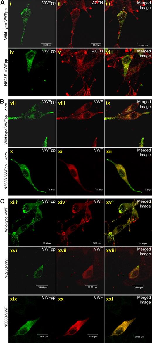 Figure 5. Trafficking of N528S-VWFpp and coexpressed mature VWF in AtT-20 cells. (A) AtT-20 cells were transiently transfected with wild-type VWFpp or N528S-VWFpp. Transfected cells were fixed and dual-stained for VWFpp (i, iv) and ACTH (ii, v) and examined by confocal microscopy. The merged image of the 2 stains is shown in the last column (iii, vi) with colocalization shown in yellow. Both wild-type VWFpp and N528S-VWFpp appear to traffic to endogenous ACTH-containing storage granules. (B) Wild-type VWFpp and N528S-VWFpp were coexpressed with propeptide-deleted VWF (Δpro) in AtT-20 cells. Transfected cells were dual-stained for VWFpp (vii, x) and VWF (viii, xi). The merged image shown in the last column (ix, xii) with colocalization shown in yellow. For wild-type VWFpp coexpressed with Δpro, both VWFpp and VWF were colocalized in granules, whereas for N528S-VWFpp with Δpro, only VWFpp was localized in granules, and VWF demonstrated diffuse staining. (C) Wild-type and N528S-VWF were expressed and cells were dual-stained for VWFpp (xiii, xvi, xix) and VWF (xiv, xvii, xx). The merged image shown in the last column (xv, xviii, xxi) with colocalization shown in yellow. For wild-type VWF, both VWFpp and VWF were colocalized in granules. Cells expressing N528S-VWF showed either granular VWFpp staining with diffuse VWF staining or diffuse staining for both proteins.