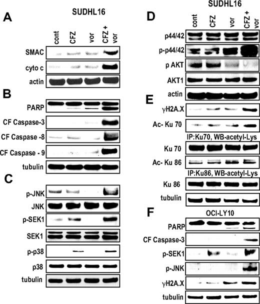 Figure 2. Combined exposure of SUDHL16 and OCI-LY10 cells to CFZ and vorinostat leads to a pronounced increase in caspase activation, mitochondrial damage, JNK activation, and DNA damage. SUDHL16 cells were treated with CFZ (3.0nM) with or without vorinostat (0.75μM) for 14 hours. (A) Cytosolic (S-100) fractions were obtained as described in “S-100 fractions,” and the expression of cytochrome C and apoptosis inducing factor (AIF) was monitored by Western blot. (B-E) Proteins from whole-cell lysates were prepared, and expression of the indicated proteins was determined by Western blotting after drug exposure identical to that described in panel A. Expression of acetylated Ku70 and acetylated Ku86 was determined by immunoprecipitation with Ku70 and Ku86 antibodies followed by Western blotting with acetyl-Lys primary antibody. (F) OCI-LY10 cells were treated with CFZ (7.0nM) with or without vorinostat (1.5μM) for 24 hours. Cells were lysed, sonicated, proteins denatured, and subjected to Western blot analysis using the indicated primary antibodies. Each lane was loaded with 20 μg of protein; blots were stripped and reprobed with antibodies directed against tubulin or actin to ensure equivalent loading and transfer. Results are representative of 3 separate experiments.