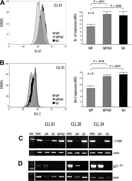 Figure 3. Differential expression of Ki-67, Bcl-2, c-myc, and p27−kip1 in CLL B cells with ongoing IgG CSR and in their IgM counterpart. (A-B) Flow cytometric analysis, in a representative patient with UM CLL, showing the Ki-67 and Bcl-2 protein expressions, respectively. Values are mean ± SE of mean fluorescence intensity (MFI) of, respectively, Ki-67 and Bcl-2 expression from 6 patients with UM CLL with high AID expression levels. (C-D) Semiquantitative RT-PCR from the cell sorter–isolated subpopulations with c-myc–specific primers (C) and with p27−kip1-specific primers (D) are depicted. GAPDH was amplified in all cases as internal semiquantitative control.
