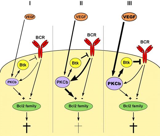 Hypothetical model of the influence of VEGF on BCR signaling in 3 scenarios: (I) Lack of adequate VEGF stimulation leads to low PKCbeta expression and insufficient survival signals along the BCR signaling pathway. (III) A too strong PKCbeta signal may lead to excess negative feedback via Btk and again negatively impact on the critical ratio of prosurvival and death signals likely converging in the Bcl2 family. Only an optimal BCR signaling strength may be able to support CLL survival (II) and VEGF may be an important determinant of the fine tuning.