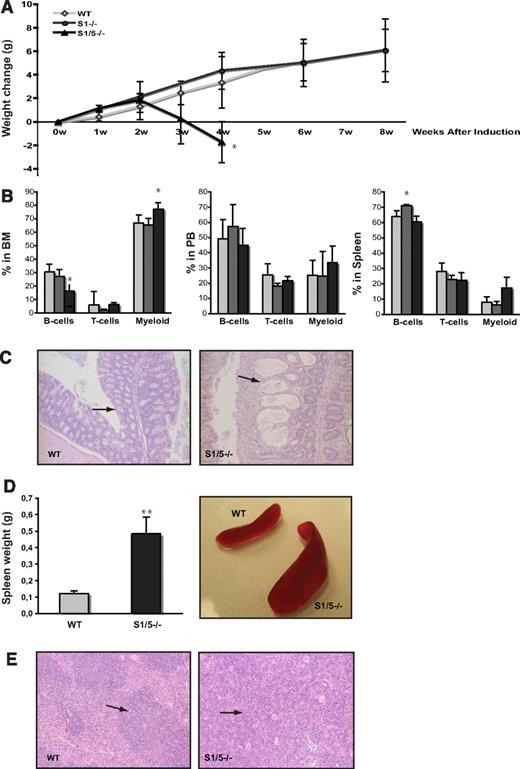 Figure 1. Induced deletion of Smad1 and Smad5, but not Smad1 alone, results in death because of pathology in the colon. (A) Weight change after induced deletion of Smad1 (S1−/−) and Smad1/Smad5 (S1/5−/−). (B) Lineage distribution in BM (left), PB (middle), and spleen (right) of induced mice (B cells; B220, T cells; CD3, and myeloid cells; Mac-1). Data are mean ± SD (n = 7 for WT, 3 for S1−/−, and 4 for S1/5−/−). *P < .05, **P < .001. represent WT; , S1−/−; and ▬, S1/5−/−. (C) Pathologic changes in the colon submucosa of S1/5−/− mice (right) compared with WT (left; original magnifications ×100). (D) Spleen weights are mean ± SD (n = 7) (left), representative spleens from WT and S1/5−/− mice (right). (E) Representative histologic photographs of WT (left) and enlarged S1/5−/− spleens (right; original magnifications ×100). The arrows indicate the red pulp of the spleen.