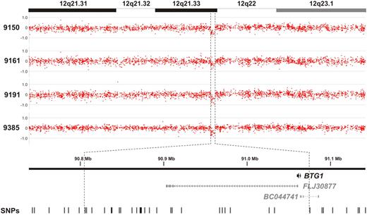 Figure 1. BTG1 copy number loss is observed in approximately 10% of pediatric pre-B ALL cases. Genomic profiles of the chromosome 12q21.31-23.1 segment in 4 pre-B ALL cases. Indicated is a region less than 300 kb in size containing the BTG1 gene, with the positions of the 2 hypothetical proteins FLJ30877 and BC044741 and the SNPs represented on the array.