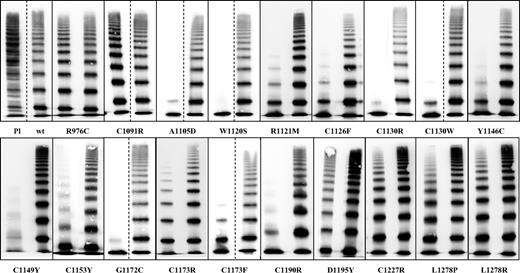 Figure 3. Multimers of 19 recombinant VWF2A/IIE mutants compared with plasma (Pl) and recombinant wtVWF. This figure is a composite of several gels. The first lane in the particular boxes represents the homozygous expression; the second lane represents the coexpression experiment. Most samples were analyzed side by side on the same gel. Dashed lines indicate that the 2 mutants were not analyzed on the same gel. Mutants with C1153Y were analyzed on the same gel but not side by side.