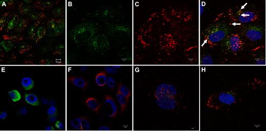 Figure 3. Immunolocalization of FVIII and VWF in CHO and ECs by confocal microscopy. CHO cells transfected with an expression vector for FVIII (E) or for VWF (F), HCMECs (A-D), and HUVECs (G-H) were costained for VWF (in red) and FVIII (in green). Nuclei are counterstained with DAPI (blue) in panels D through H. Cells were analyzed by a Multiphoton Zeiss CLSM510 META NLO confocal microscope equipped with LSM 510 acquisition software, Version 4.2.SP1 (Carl Zeiss). All images are taken with a Plan-Apochromat 63×/1.4 oil DIC objective at 2× zoom (B-H) or without zoom (A). Images in panels B through D and G and H are 3D reconstructions. Top panels are (A) representative merge image of FVIII and of VWF costaining in HCMECs (bar, 10 μm); (B-C) staining of FVIII and of VWF, respectively, in HCMECs; (D) merged image of panels B and C. White arrows point out some colocalizations of FVIII and VWF (bars, 5μm). Bottom panels are CHO-FVIII (E), CHO-VWF (F), and HUVECs (G-H) costained for FVIII and VWF (bars, 5 μm).