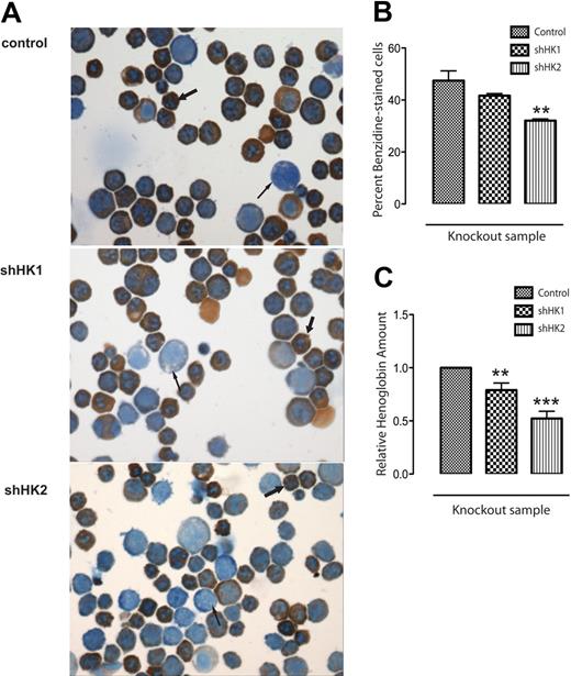 Figure 5. Specific knockdown of Hipk2 reduces hemoglobin accumulation. GFP+ cells were sorted from fetal liver erythroid cultures grown in Epo-containing media 36 hours after shRNA retroviral infection. (A) Slides made from cytospins of infected cells were fixed and stained with benzidine-Giemsa (original magnification 40×). Positively stained cytoplasm reflects the presence of hemoglobin: the more differentiated orthochromatophilic erythroblasts (thick arrow) show more hemoglobin staining than the remaining early erythroblasts (thin arrow). (B) Quantification of positively stained, hemoglobinized cells, expressed as the percentage of stained cells in 5 unique 40× fields for each sample; n = 5 (mean ± SEM). **P < .01. (C) Equal numbers (1 × 106) of GFP+ cells were lysed with 200 μL Drabkin reagent and spectrophotometric readings made at 540 nm; n = 5 (mean ± SEM). **P < .01; ***P < .001.