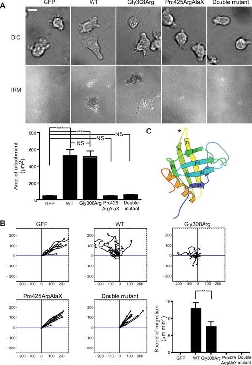 Figure 6. Adhesion and migration characteristics of LAD-III B cells expressing human WT and mutant kindlin-3-GFP. (A) DIC and IRM images of the LAD-III patient's EBV-transformed B cells transfected with GFP cDNA were compared with cells transfected with WT KINDLIN3, Gly308Arg, Pro425ArgAlaX, and double mutant KINDLIN3 cDNAs. Images are representative of 20 fields per sample; n = 3. Quantification of the area of close contact from one typical experiment; n = 30 cells/group. Data are shown as mean ± SEM; ***P < .001; NS indicates not significant. Scale bar represents 10 μm. (B) Migration characteristics of LAD-III B cells transfected with GFP cDNA were compared with cells transfected with WT KINDLIN3-GFP, Gly308Arg, Pro425ArgAlaX, and double mutant KINDLIN3-GFP cDNAs. n = 3 for each cDNA construct. Single-cell tracking images are accompanied by quantification of average speed of migration for n = 15 cells/group from a representative experiment. Data are shown as mean ± SEM; **P < .01. (C) Model of the kindlin-3 PH domain showing location of the Pro425AlaArgX truncation mutation (*) in the loop between the β6 and β7 strands.