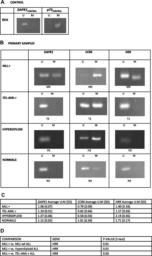 Figure 6. Methylation-specific PCR demonstrates preferential promoter methylation of genes of interest in MLL-r ALL compared with MLL-wt ALL and normal controls. DNA from the REH cell line and HELP primary samples were treated with bisulfite to specifically convert unmethylated cytosines to uracil. PCR primers for anticipated post–bisulfite-methylated (M) and unmethylated (U) promoter sequences for the genes DAPK1, p73, CCR6, and HRK were used to determine their methylation status. (A) REH cells were used as control to assure complete bisulfite conversion because in REH cells the DAPK1 promoter is completely unmethylated whereas the p73 promoter is completely methylated. (B) Examples are shown from treatment of the HELP assay primary samples. In DAPK1 and HRK, only the MLL-r sample shows a methylated amplicon. In CCR6, although all samples show methylated amplicons, the MLL-r sample is clearly preferentially methylated as it shows only a dim unmethylated amplicon. (C) Densitometry was performed on all amplicons for all primary samples in each group and average unmethylated amplicon–methylated amplicon (U:M) densitometry ratios and their SDs are shown. The DAPK1 and HRK promoters are preferentially methylated in MLL-r ALL cells in comparison with other leukemias and normals; CCR6 promoters have some methylation in all leukemias, whereas in MLL-r ALL it is preferentially methylated and preferentially unmethylated in normals. (D) With the exception of, in the CCR6 gene, MLL-r versus other leukemias and MLL-r versus hyperdiploid ALL (where hyperdiploid leukemia showed greater methylation than MLL-r) all genes and groups compared trended toward statistical significance, with MLL-r leukemia having a lower U:M ratio (more methylation); despite small numbers, several comparisons reached statistical significance and are listed.