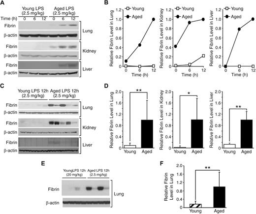 Figure 2. Age-dependent coagulation during endotoxemia. (A) Western blot analysis of a time course experiment examining fibrin formation in lung, kidney, and liver of young (4 months) and aged (24 months) mice that were sacrificed 6 and 12 hours after LPS injection (2.5 mg/kg, intraperitoneal). The control mice without LPS injection are represented by 0 h. Each lane contained 40 μg of protein derived equally from 5 individual mice. Each membrane was reprobed with anti–β-actin antibody to assure equal protein loading. (B) Densitometric analysis of panel A. (C) Fibrin formation 12 hours after LPS injection was further compared among individual samples, which were pooled in panel A. Each lane contained 40 μg of protein from an individual mouse. (D) Densitometric analysis of panel C. (E) Western blot analysis comparing thrombosis in lungs from young mice with a high dose of LPS (20 mg/kg) and aged mice with a low dose of LPS (2.5 mg/kg; n = 4 in each group). Each lane represents a protein sample from an individual mouse. (F) Densitometric analysis of panel E. (D-F) Data are mean ± SD. *Statistical significance (P < .05). **Statistical significance (P < .01).