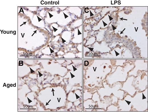 Figure 5. Age-dependent loss of TM in pulmonary vascular cells during endotoxemia. Immunohistochemical analysis of TM was performed on lung sections from young (4 months) and aged (24 months) mice that were sacrificed 12 hours after LPS injection (2.5 mg/kg, intraperitoneal). Strong positive immunostaining for TM is seen in young control (A), aged control (B), and young mice with LPS (C), but not in aged mice with LPS (D). Control mice received no LPS. TM-positive cells in capillaries and large vessels (V) are indicated by arrowheads and arrows, respectively (original magnification ×400).