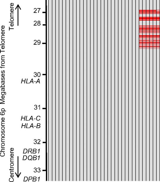 Figure 2. Subtypes of HLA haplotype P1. Data from chromosome 6p (from nucleotides 26252770-33187790) of 32 persons with consecutive homozygous SNPs throughout the 6.9-Mb region. The SNP sequence of persons was compared with consensus sequence across the 6.9-Mb region. Each column indicates 1 person. Each of 1395 evenly spaced rows represents 1 SNP locus. Gray row represents SNPs identical to the consensus alleles; and red row, SNPs different from the consensus alleles. Missing SNPs were not counted. A total of 26 of 32 persons had alleles identical to consensus alleles across 6.9 Mb (subtype A of HP-P1), whereas the remaining 6 persons had apparently different alleles in the telomeric region from nucleotide 29414635 (subtype B of HP-P1). These data indicated that the telomeric region of HP-P1 was clearly divided into 2 different haplotypes.