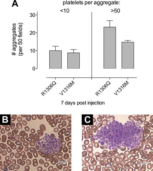 Figure 5. Platelet aggregates in VWF/ADAMTS13-deficient mice expressing mVWF/R1306Q or mVWF/V1316M. Blood smears prepared at day 7 after injection in VWF/ADAMTS13 double-deficient mice. (A) Quantitative analysis of platelet aggregates. Per mouse, 50 microscopic fields were analyzed (n = 6 for each mutant). Two types of platelet aggregates could be distinguished: < 10 platelets/aggregate or > 50 platelets/aggregates. No intermediate-sized platelet aggregates (10-50 platelets/aggregate) were observed. Data represent mean ± SE. Both mutants display a significant increase in the number of very large aggregates compared with their expression in VWF-deficient mice (P < .01). (B-C) Representative blood smear samples of mVWF/R1306Q (B) and mVWF/V1316M (C). Microscopy was performed with the use of a Axioimager-A1 microscope (Carl Zeiss) with a Plan-Apochromat 100×/1.4 oil-immersion objective (Carl Zeiss). Images were acquired with an Axiocam HRc camera (Carl Zeiss) and the Axiovision 4.5 software (Carl Zeiss).