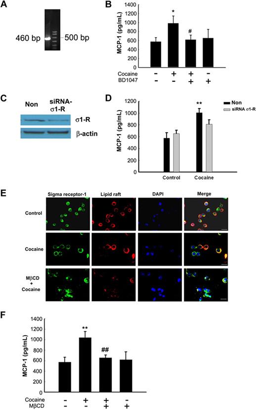 Figure 2. Engagement of σ-1R is critical for cocaine-induced MCP-1 expression in microglia. (A) RNA isolated from cocaine-treated BV-2 cells was subject to RT-PCR analysis using σ-1R primers. (B) Pretreatment of BV-2 cells with σ-1R antagonist BD1047 abolished cocaine-mediated induction of MCP-1 expression in BV-2 cells. (C) Whole-cell lysates from BV-2 cells transfected with either σ-1R or nonsense (Non) siRNAs were subject to Western blot analysis using antibodies specific for σ-1R. (D) σ-1R siRNA, but not Non siRNA, inhibited cocaine-mediated induction of MCP-1 expression. (E) BV-2 cells were treated with cocaine and double-stained using antibodies specific for ganglioside GM1-lipid raft marker (red TRITC fluorescence) or σ-1R (green FITC fluorescence). Overlay images are shown in the right panel. Data are representative from 3 typical experiments. Scale bars all indicate 20 μm. (F) Role of lipid rafts play in cocaine-mediated induction of MCP-1 in BV-2 cells. Cells were pretreated with MβCD (1mM) followed by treatment with cocaine. Supernatant fluids were harvested at 12 hours after cocaine treatment, followed by assessment of MCP-1 expression by ELISA. All the data are presented as means ± SD of 4 individual experiments. *P < .05; **P < .01 versus control group; #P < .05; ##P < .01 versus cocaine-treated group.