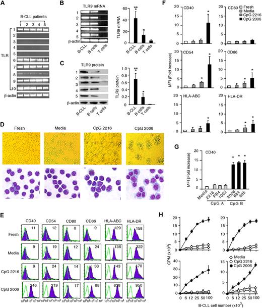 Figure 1. Human B-CLL cells express high levels of TLR9 and can be potently activated by CpG-B ODNs. Purified B-CLL cells from CLL patients 1 to 5 in Table 1 were used and tested. (A) RT-PCR results of TLR1-10 expression profile in B-CLL cells from 5 CLL patients. (B) RT-PCR results of TLR9 mRNA expression and (C) Western blot results of TLR9 protein expression in B-CLL cells from 5 patients were compared with that of normal B and T cells from 5 healthy blood donors, and normalized to the expression of β-actin. Data are presented as the mean ± SD in the adjacent bar diagram. *P < .01, B-CLL cells and B cells versus T cells. **P < .01, B-CLL cells versus B cells. (D) Morphologies of fresh and day 3 cultured B-CLL cells with or without CpG-A or CpG-B ODN were examined. Images of B-CLL cells in cultures were acquired on an Olympus CKX41 inverted microscope with an Olympus DP12 digital microscope camera at 200× magnification. Images of Giemsa staining of B-CLL cells were acquired on a Zeiss Axioplan 2 Upright Microscope (Carl Zeiss Inc) with a Spot RT color digital camera (Diagnostic Instruments), captured with a Zeiss Plan-Apochromat 63×/1.4 oil objective lens at 630× magnification, and processed with Spot advanced 4.6 software. (E) Expression of surface markers (shaded histogram) on fresh or day 3 cultured B-CLL cells with or without CpG-A or CpG-B ODN was analyzed by flow cytometry, indicated with MFI number, and overlaid with isotype control (unshaded histogram). Data are representative results from 1 of 5 CLL patients. (F) MFI fold increases of the indicated surface molecules on day 3 cultured versus uncultured B-CLL cells. Data are the mean ± SD from 5 independent experiments. *P < .01. (G) MFI fold increases of CD40 expression on day 3 cultured B-CLL cells with CpG-A or CpG-B ODNs versus B-CLL cells cultured in media only. Data are the mean ± SD from 5 independent experiments. *P < .01. (H) Graded doses of irradiated day 3 cultured B-CLL cells with or without CpG ODNs were used as stimulators to allogeneic T cells in MLR assays. Data are representative results with B-CLL cells from 4 CLL patients. The error bars represent the SD of triplicates. The independent experiments were performed with B-CLL cells derived from different CLL patients