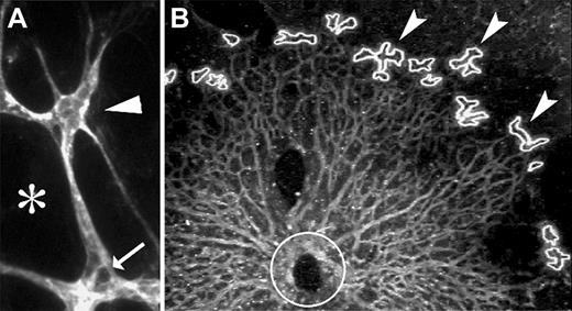 Figure 1. Retinas were sectioned en face to isolate the vascular layer and stained with fluorescent-labeled isolectin. Tip cells (arrowhead) were identified by their position at the distal edge of the vasculature and by the presence of filopodia in P1 or P2 retinas. (A) Stalk cells (arrows) and adjacent nonvascular retina tissue (*) were also harvested. (B) Burn marks indicate where tip cells have been removed by LCM (arrowheads) from P2 retina. Circle represents the optic nerve head region.