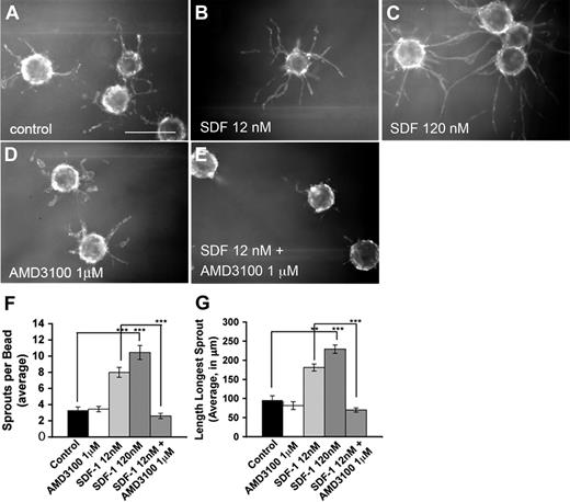Figure 3. SDF-1 stimulates capillary formation in vitro. (A-E) HUVECs were coated on polystyrene beads and embedded in a fibrin matrix; 12nM (B) or 120nM (C) SDF-1 added to the media stimulates both the length of the longest sprout per bead and sprout number per bead in a dose-dependent manner. A total of 1μM AMD3100 (D) alone has no effect on capillary outgrowth but reduces SDF-1–stimulated outgrowth to control levels (E). Quantification is shown in panels F and G. Original magnification × 40. Scale bar represents 100 μm. For quantification, 2.5× images were taken of the center of a 4-well plate. Sprout lengths and numbers were quantified from 10 beads from the upper left-hand quadrant of this image. Beads were not counted if their sprouts did not lie entirely within the image. If fewer than 10 beads were found in the upper left quadrant, beads were counted from the upper right quadrant and so on in a clockwise manner until 10 were quantified. For each experiment, 2 wells for each condition were quantified. Experiments were repeated 3 separate times, and representative data are shown. Error bars represent SEM. Statistical analysis was performed using the unpaired Student t test assuming equal variance for pairwise comparison of treatment groups: **P < .05, ***P < .005.
