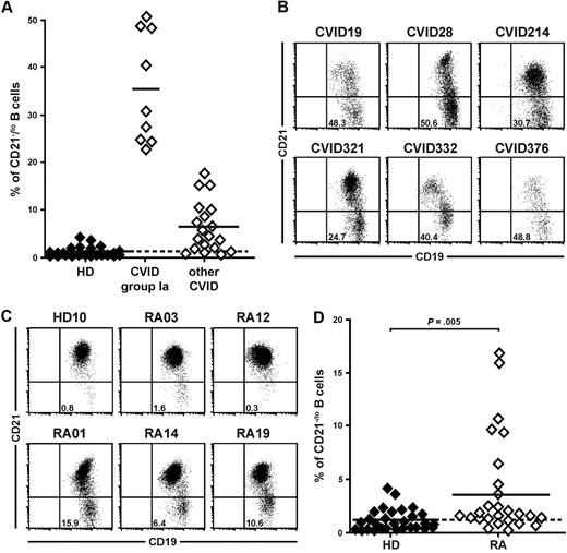 Figure 1. CVID and RA patients may display an increased frequency of CD21−/lo B cells in their blood. (A) CVID group Ia patients were previously defined as patients displaying a frequency of CD21−/lo naive B cells > 20% of total B cells.21 Each diamond represents a person and (B) dot plots show CD19 and CD21 expression on CD27−-gated peripheral B cells from representative CVID group Ia patients. (C) Increased CD21−/lo B-cell frequency in RA patients. Dot plots show CD19 and CD21 expression on CD27-depleted peripheral B cells from a representative healthy donor (HD10) and RA patients. (D) The frequencies of CD21−/lo naive B cells are compared between healthy donors and RA patients. Each diamond represents a person and statistically significant differences are indicated.