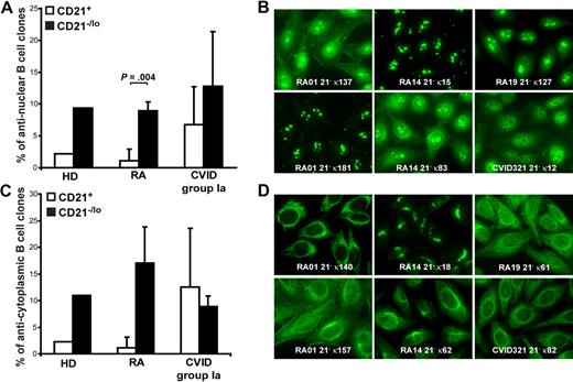 Figure 3. CD21−/lo B cells contain antinuclear and anticytoplasmic clones. The frequencies of antinuclear (A) and anticytoplasmic (C) clones in CD21+ and CD21−/lo B cells from HD, RA, and CVID patients are shown. P values calculated using a paired t test are indicated when significant. (B) ANAs expressed by CD21−/lo B cells showed a diversity of nucleolar (RA01 21− κ181, RA01 21− κ137, RA14 21− κ15, and RA14 21− κ83), nucleolar and speckled (RA19 21− κ127), and speckled (CVID 21− κ12) antinuclear staining patterns. (D) Anticytoplasmic CD21−/lo B cells can react with well-defined intracellular structures, which include mitochondria (RA01 21− κ140, and CVID321 21− κ82), the Golgi (RA14 21− κ18), and cytoplasmic fibers (RA19 21− κ61, RA14 21− κ62, and RA01 21− κ157 that is likely to recognize actin).