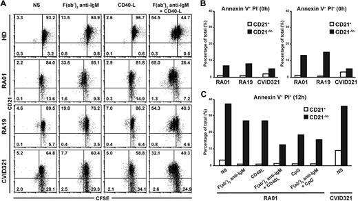 Figure 5. CD21−/lo naive B cells do not proliferate after BCR and CD40 cotriggering and are prone to cell death. (A) Total naive B cells from healthy donors (HD), and RA and CVID patients containing both CD21−/lo and CD21+ B cells were labeled with CFSE and stimulated with F(ab′2) anti-IgM and/or recombinant human CD40L. Dot plots show CD21 expression according to CFSE dilution after 3 days. CFSE dilution in CD21+ but not in CD21−/lo B cells stimulated with F(ab′2) anti-IgM and recombinant human CD40L reveals that some CD21+ B cells underwent up to 2 divisions, whereas CD21−/lo B cells did not divide. (B) Increased frequency of annexin V+ propidium iodide–negative (PI−) early apoptotic, and annexin V+ PI+ late apoptotic and dead cells in freshly isolated CD21−/lo naive B cells from RA and CVID patients compared with their CD21+ B-cell counterparts. (C) BCR, CD40, and/or TLR9 triggering do not prevent the apoptosis and cell death of CD21−/lo naive B cells. Total naive B cells containing both CD21−/lo and CD21+ B cells from RA01 or CVID321 patients were plated, and annexin V and PI staining was assessed after 12 hours. BCR, CD40, and TLR9 stimulation prevents late apoptosis and cell death in CD21+ but not in CD21−/lo B cells.