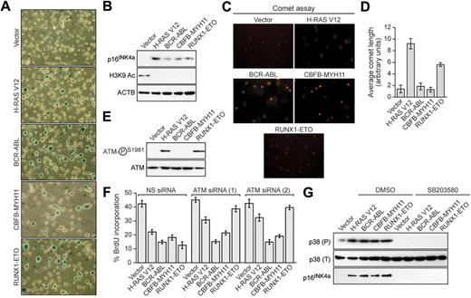 Figure 2. Leukemogenic fusion proteins induce senescence in hematopoietic progenitors. (A) Bone marrow cells were isolated from 5-fluorouracil-treated mice, transduced with a retrovirus expressing empty vector, H-RAS V12, or a leukemogenic fusion protein, and stained for senescence-associated β-galactosidase. (B) Immunoblot analysis monitoring levels of p16INK4a and H3K9 Ac in hematopoietic cells expressing empty vector, H-RAS V12, or a leukemogenic fusion protein. (C) Hematopoietic cells expressing empty vector, H-RAS V12, or a leukemogenic fusion protein were analyzed by comet assay under alkali conditions. (D) Quantification of comet tail length. Error bars represent SEM. (E) Immunoblot analysis monitoring levels of phospho-ATM and, as a control, total ATM in hematopoietic cells expressing empty vector, H-RAS V12, or a leukemogenic fusion protein. (F) BrdU incorporation assay in hematopoietic cells stably expressing either a nonsilencing (NS) siRNA or one of 2 unrelated siRNAs directed against ATM, and expressing empty vector, H-RAS V12, or a leukemogenic fusion protein. Error bars represent SEM. (G) Immunoblot analysis of phosphorylated p39 (P), total p38 (T), and p16INK4a levels in hematopoietic cells expressing empty vector, H-RAS V12, or a leukemogenic fusion protein treated with dimethyl sulfoxide (DMSO) or SB203580.