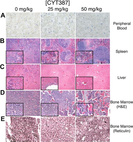 Figure 3. Histopathology after CYT387 treatment of JAK2-dependent malignancy in vivo. Balb/c mice were subjected to bone marrow transplantation with bone marrow donor cells retrovirally transduced to express JAK2V617F. Thirty-four days after transplantation, mice exhibited symptoms of MPN as measured by elevated white blood cell counts and hematocrit. Mice were divided into 3 groups and initiated on twice daily oral gavage administration of vehicle control, 25 mg/kg CYT387, or 50 mg/kg CYT387 (n = 12 per group). At day 83 after bone marrow transplantation, all mice were killed and representative histologic sections are shown from: (A) peripheral blood stained for reticulocytes, (B) spleen stained with H&E, (C) liver (H&E), (D) bone marrow (H&E), and (E) bone marrow (reticulin stain). The left column represents 0 mg/kg CYT387, the middle column represents 25 mg/kg CYT387, and the right column represents 50 mg/kg CYT387. Magnification is ×10 or ×40 for insets.