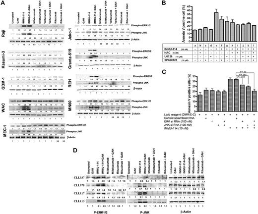 Figure 4. Comparison of signaling pathways in IMMU-114–sensitive and –resistant cells. (A) Western blot analyses of ERK1/2 and JNK1/2 phosphorylation on cell extracts of IMMU-114–sensitive and –resistant cell lines after mAb treatment. (B) Effect of ERK, JNK, and ROS inhibitors on IMMU-114–mediated apoptosis in Raji. NAC (5mM) was used to block the ROS. U0126 (10μM) blocks MEK phosophorylation and the ERK1/2 pathway. SP600125 (10μM) blocks the JNK pathway. (C) Effect of siERK and siJNK RNAs on the expression of ERK and JNK proteins. Error bars represent SD of 3 replicates. (D) Western blot analyses of ERK and JNK pathways in CLL patient samples.