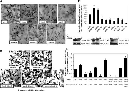 Figure 1. Jam-B and Jam-C are required for EC lumen and tube formation in 3D collagen matrices. (A) ECs were treated with the indicated siRNAs and were cultured in 3D collagen matrices for 24 hours before fixation, staining, and photography. Arrows indicate EC lumens. Bar equals 50 μm. SP indicates Smartpool siRNAs from Dharmacon; the other siRNAs are individual single siRNAs. Thus, we used 2 independent siRNAs for each target analyzed. In some cases, we mixed single siRNAs to assess the influence of more than 1 Jam family member. (B) EC lumenal areas were quantitated from the cultures in panel A were traced using Metamorph software. Data shown are normalized to the control sample and presents values of lumenal area per high-powered field (HPF) ± SD. n = 20, P < .01. (C) siRNA-transfected EC lysates were analyzed using Western blots to assess Jam-A, Jam-B, Jam-C, or β-actin (control) expression. (D) ECs were treated with the indicated siRNAs followed by treatment with the indicated adenoviruses. Cultures were established to assess the ability of the treated ECs to form lumens and tubes for 24 hours. Arrows indicate EC lumens. Bar equals 50 μm. (E) EC lumenal areas were quantitated from the cultures in panel D were traced using Metamorph software. Data shown are normalized to the control sample and presents values of lumenal area per HPF ± SD. n = 20, P < .01. Panels B and E: * indicates a significant decrease; +, a significant increase.
