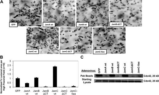 Figure 3. Jam-B and Jam-C cytoplasmic tails are required for EC lumen and tube formation as well as Cdc42 activation in 3D collagen matrices. (A) ECs were infected with the indicated recombinant adenoviruses overnight and then were resuspended in 3D collagen matrices. After 24 hours, cultures were fixed, stained, and photographed. Arrows indicate EC lumens. Bar equals 50 μm. (B) EC lumens were quantitated by tracing lumen areas using Metamorph software. Data shown are normalized to the control sample and presents values of lumenal area per HPF ± SD. n = 10, P < .01. (C) Cultures were established as in panel A, and after 16 hours, detergent lysates were prepared from the 3D cultures and incubated with GST-PAK-PBD protein beads as described16 to assess the degree of Cdc42 activation. Starting material lysates as well as the eluates from the Pak beads were assessed by Western blot analysis using anti-Cdc42 antibodies.
