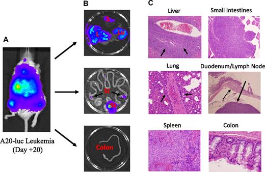 Figure 5. A20 leukemia cells do not traffic to the colon. (A) Lethally irradiated Balb/c mice were administered 5 × 105 A20-luc cells and then transplanted the next day with B6 BM cells. Serial BLI studies were performed, and mice were killed 20 days after transplantation when leukemic dissemination was widespread. (B) BLI of individual organs, specifically the spleen (S), liver (L), lung (Lu), small intestines (SI), stomach (St), and colon from a representative mouse with disseminated A20 leukemia demonstrating tumor involvement in the spleen, liver, lung, stomach, and small intestines but not in the colon. (C) Pathologic examination of the same tissues that were imaged in panel B. In the liver, there is extensive leukemic infiltration around the portal triads (arrows). Leukemia cells are present in the interstitium of the lung and exhibit perivascular cuffing (arrows), and there is effacement of the red and white pulp by leukemia cells in the spleen. A20 cells are also present in the Peyer patches of the small intestines and extend into adjacent villi. Nodal tissue (solid arrow) that was contiguous to the duodenum (hatched arrow, Brunner glands) was observed to be replaced with leukemia cells as well. Leukemia was not detectable in the colon. One representative animal of 11 individual mice is shown in panels B and C. Images were obtained with an Olympus DP70 digital camera and an Olympus BX45 microscope with a 40×/0.75 NA lens.