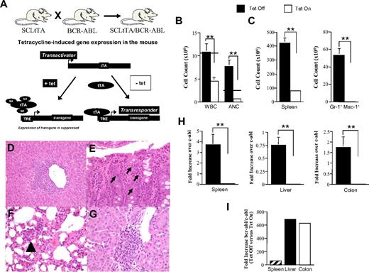 Figure 6. Leukemia cells are present in the colon in transplantation recipients with CML. (A) Schematic illustrating tet-induced repression of bcr/abl gene expression obtained after crossing ScltTA with bcr/abl mice to produce double-transgenic CML animals. tet binds to the tetracycline-controlled transactivator (tTA), which prevents binding of tTA to the tetracycline response element (TRE) resulting in repression of bcr/abl transcription. In the absence of tet, the tTA is able to bind to the TRE, and there is expression of bcr/abl. (B) Lethally irradiated (1000 cGy) FVB mice were transplanted with TCD B6 BM (10 × 106) and non-TCD BM (10 × 106) cells from CML (SCLTta × BCR/ABL) animals. One cohort was maintained on tet (n = 10), whereas the second was removed from tet after transplantation (n = 8). Mice in both groups were bled 48 to 52 days after transplantation. Peripheral blood was analyzed for total WBC and ANC. Horizontal lines indicate the upper limit of normal for WBC and ANC. (C) Mice in similarly transplanted cohorts (n = 9 or 10/group) were killed 52 to 57 days after BMT, and spleen size and the absolute number of Gr-1+ Mac-1+ cells were calculated. (D-G) Histology of representative mouse with underlying CML that was killed 83 days after BMT. (D) Granulocytic infiltrate surrounding a central vein in the liver. (E) Granulocytes infiltrating the crypts in the colon (arrows indicate eosinophils). (F) Immature granulocytic precursors within the interstitium of the lung parenchyma (arrow). (G) Perivascular granulocytic infiltrate in the kidney. (H-I) Lethally irradiated FVB mice were transplanted with TCD B6 BM and non-TCD BM cells from CML mice. One cohort was maintained on tet (n = 15), whereas the second group was placed on normal drinking water without tet (n = 12). Mice were killed 50 days after transplantation, and spleen, liver, and colon tissues were obtained from each animal to determine bcr/abl mRNA levels by real-time quantitative PCR. Data are presented as fold increase over c-abl in panel H. The fold increase of bcr/abl over c-abl expression in the spleen, liver, and colon of animals not on tet versus those on tet is shown in panel I. Data are the mean ± SEM. **P < .01. Panels D through G: Images were obtained with an Olympus DP70 digital camera and an Olympus BX45 microscope with a 40×/0.75 NA lens.