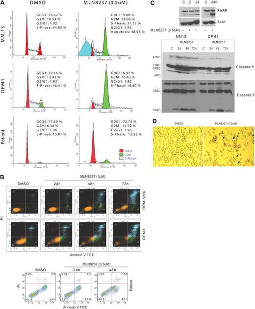 Figure 3. MLN8237 induces accumulation of G2/M phase and apoptosis in MM cells. (A) DNA profiles of MM cell lines, MM1.S and OPM1, as well as tumor cells from MM patient BM treated with DMSO or MLN8237 (0.5μM) for 24 hours were evaluated by flow cytometry. The percentage of cells in G0G1, G2M, and S phases are shown. (B) MM cell lines, RPMI8226 and OPM1, as well as tumor cells from MM patient BM were cultured with DMSO or 0.5 to 1μM of MLN8237 for 24, 48, and 72 hours. Induction of apoptosis and cell death were determined by flow cytometric analysis in MM cells costained with annexin V and PI. (C) Induction of PARP, caspase-9, and caspase-3 cleavage by MLN8237 was measured by immunoblotting in MM cell lines. (D) Representative photomicrograph of β-galactosidase activation in MLN8237 (0.5μM, 48 hours) treated MM1.S cells. Arrows indicate activated β-galactosidase (blue) in cytoplasm. The senescent MM1.S cells (β-galactosidase active, blue stain) were visualized using a light microscope (original magnification ×20).