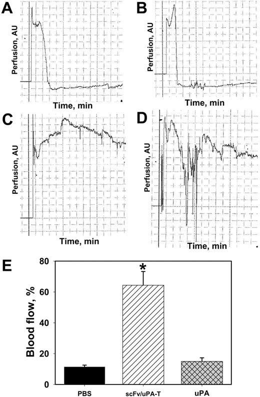 Figure 5. Prophylactic thrombolysis by scFv/uPA-T in arterial thrombosis. Panels A (saline), B (uPA), C, and D (scFv/uPA-T) show typical tracings of blood flow in the FeCl3 model of carotid artery injury. Each square on the time axis equals 200 seconds. Panel E shows analysis of the data collected from each group presented as percent of the pre-injury level of blood flow in the carotid artery during the first 30 minutes after induction of injury in mice treated with uPA or scFv/uPA-T 1 hour before injury. N = 6 per group, P < .05.